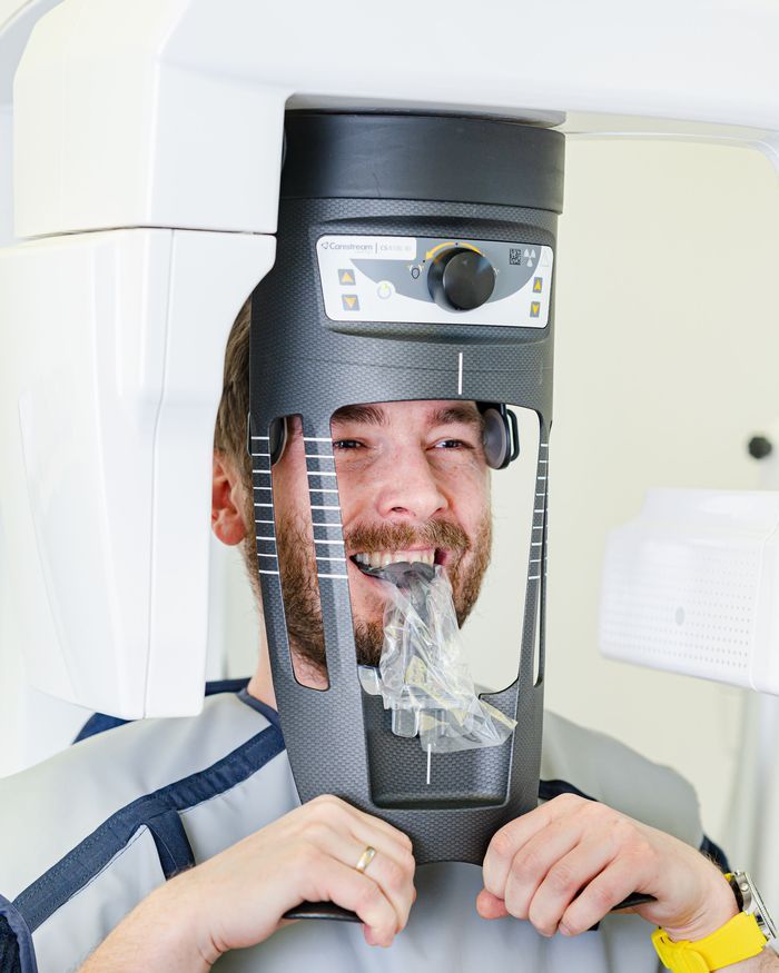 Zdjęcie skanowanych zębów